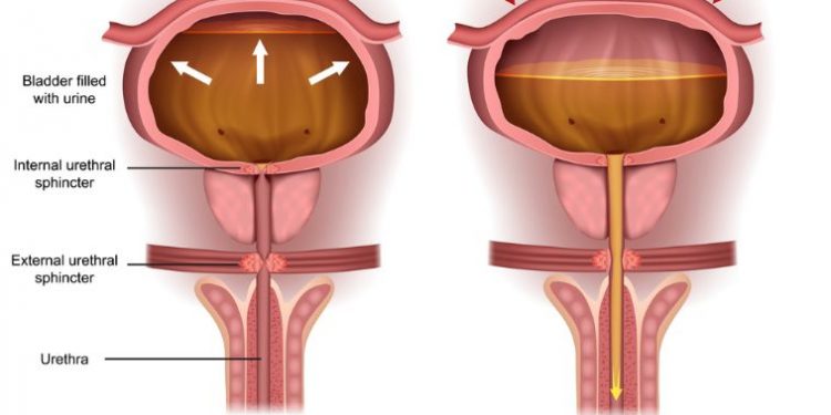 What is Prostate Specific Antigen (PSA)?