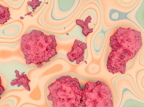 Your Metastatic Cancer Life Expectancy