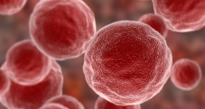 What Is Stage 4 Cancer?