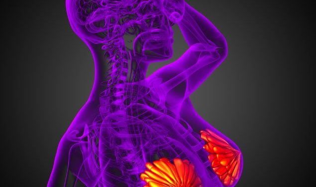 Breast Cancer in Men