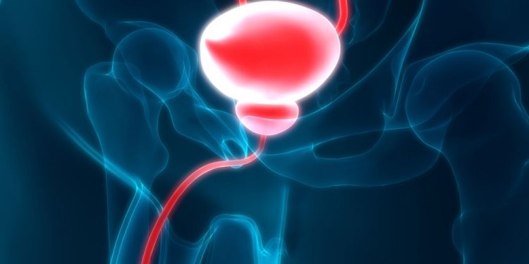 How to Shrink Your Prostate in a Matter of Seconds