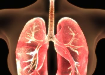 Non Small Cell Lung Cancer Stage IV