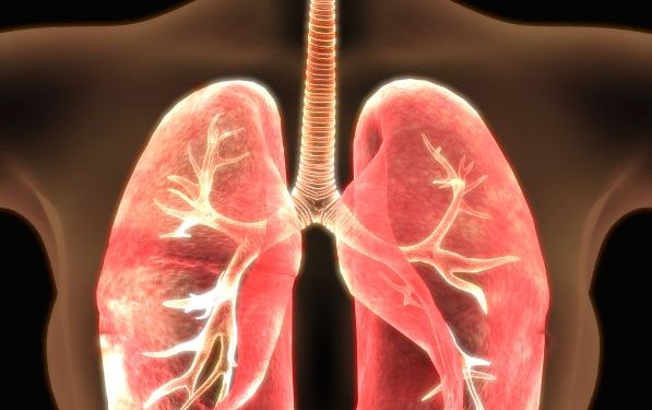 Non Small Cell Lung Cancer Stage IV