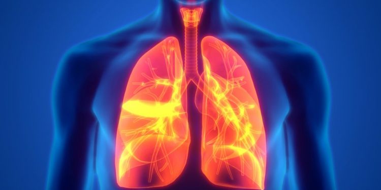 Symptoms of Lung Cancer in Females