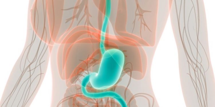 Symptoms of Stomach Cancer in Women