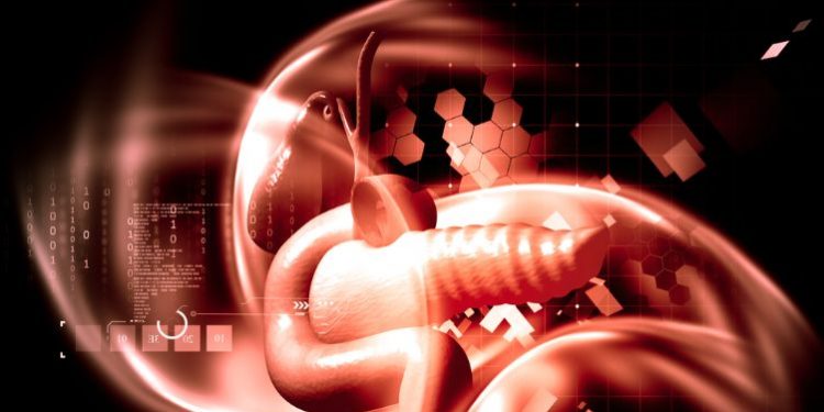 Pancreatic Adenocarcinoma