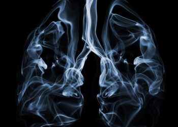 Adenocarcinoma Lung Cancer