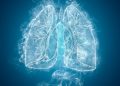 How to Deal With Lung Cancer Shortness of Breath