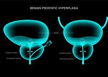 What Treatment Options Are Available For Prostate Cancer?