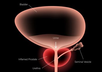 What Treatments Are Available For Stage 4 Prostate Cancer?