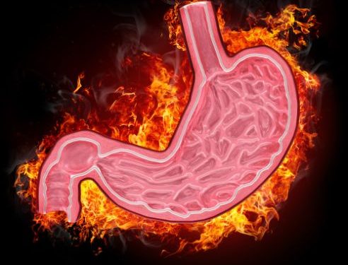 Stomach Cancer Early Symptoms