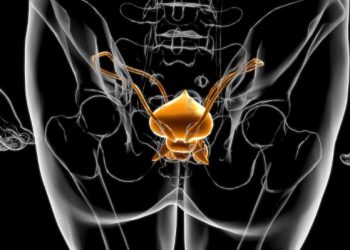 What to Expect After Prostate Prostatectomy