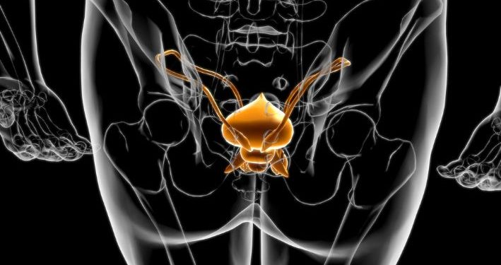 What to Expect After Prostate Prostatectomy