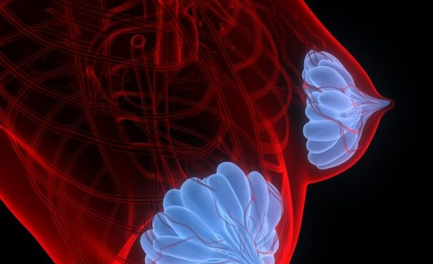 Paget’s Disease Breast