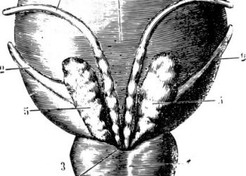 What Happens During a Prostate Biopsy