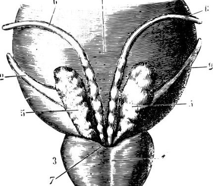 What Happens During a Prostate Biopsy