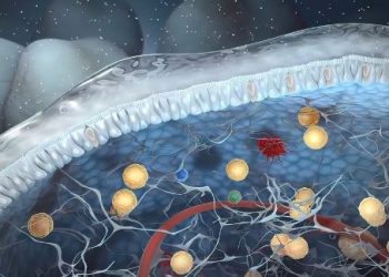 Metastatic Carcinoma