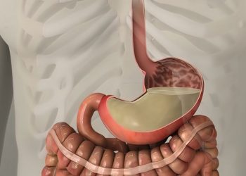 Small Bowel Obstruction Symptoms