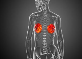 HER2-Positive Breast Cancer