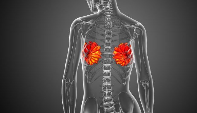 HER2-Positive Breast Cancer