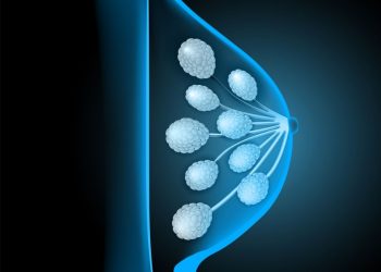 Early Signs of Breast Cancer