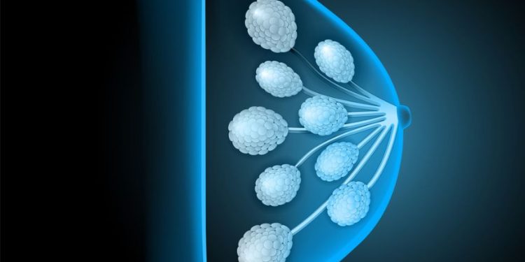 Early Signs of Breast Cancer