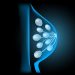 Early Signs of Breast Cancer