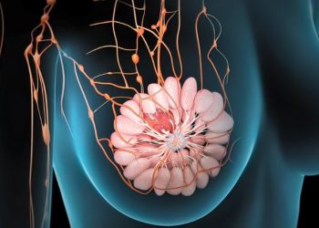 What Happens When You Have a Breast Cancer Lump?