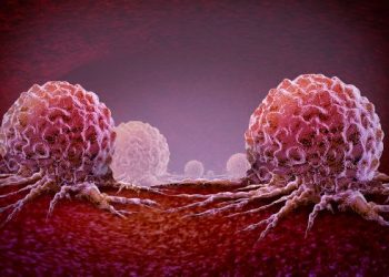 Brain Metastases – Signs, Symptoms and Treatment