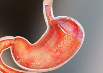 Gastroesophageal Junction Cancer