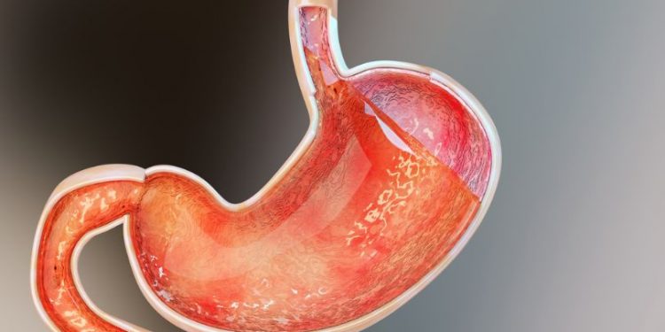 Gastroesophageal Junction Cancer