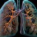 The Stage Four Lung Cancer Survival Rate