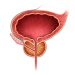 Symptoms of Prostate Problems