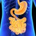 Gastric Carcinoma
