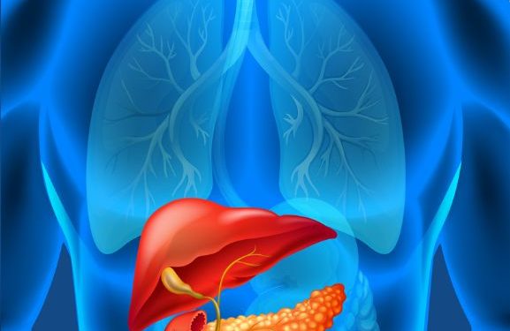 Steps to Improve Your Prognosis for Stage 4 Liver Cancer