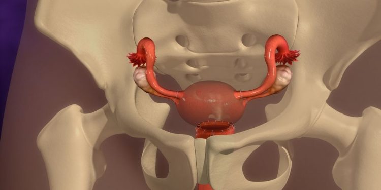 Endometrial Stromal Sarcoma