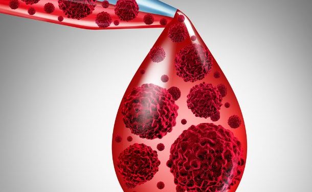 Leukemia Cancer