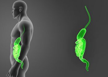 Esophageal Cancer Surgery