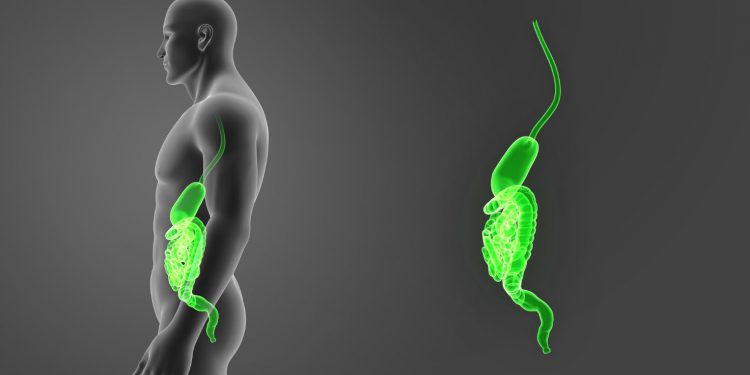 Esophageal Cancer Surgery