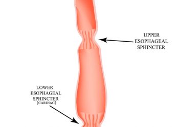 Inflamed Esophagus Symptoms