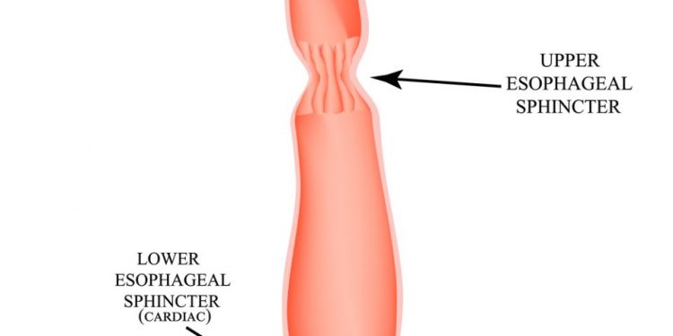 Inflamed Esophagus Symptoms