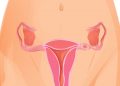 Womb Cancer Symptoms and Treatment