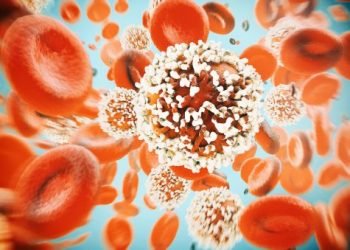 Acute Lymphocytic Leukemia