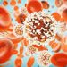 Acute Lymphocytic Leukemia