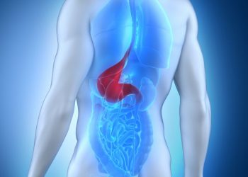 Esophageal Carcinoma