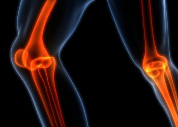 Bone Cancer Symptoms