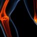 Bone Cancer Symptoms