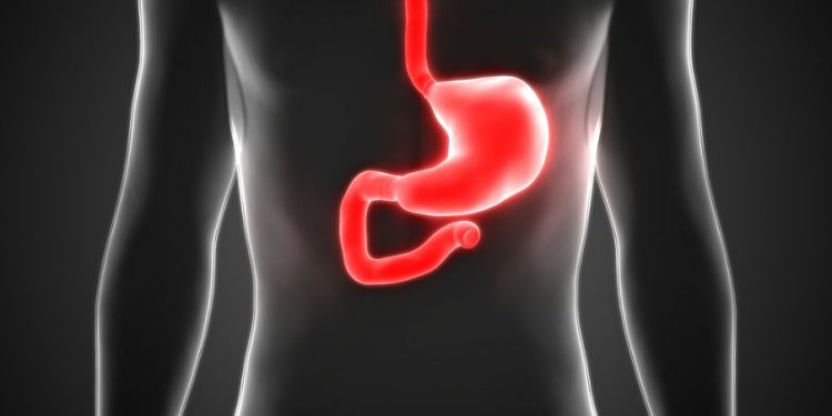 Cancer of the Esophagus