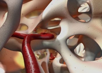 Bone Marrow Cancer Symptoms