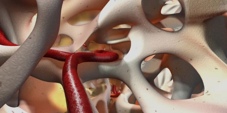 Bone Marrow Cancer Symptoms